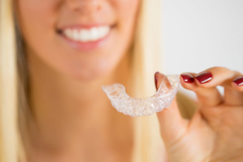 Top 10 Invisalign Questions and Answers